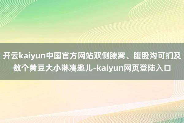 开云kaiyun中国官方网站双侧腋窝、腹股沟可扪及数个黄豆大小淋凑趣儿-kaiyun网页登陆入口